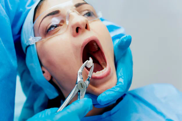 Wisdom teeth surgery at Village Family Dentistry